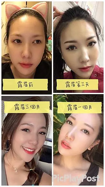 【柔霧眉零結痂全紀錄】艾偲維娜做的粉霧眉又自然又持久! 圖1